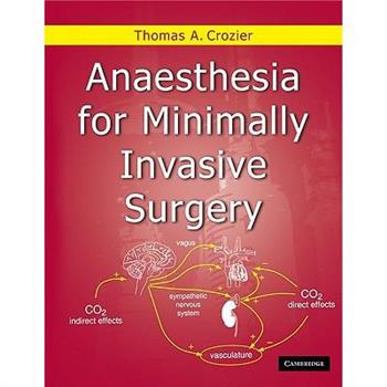 Anaesthesia for Minimally Invasive Surgery