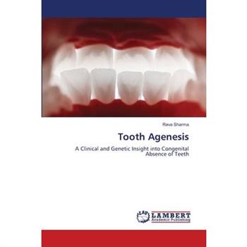Tooth Agenesis