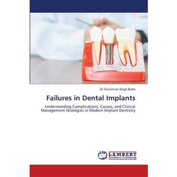 Failures in Dental Implants