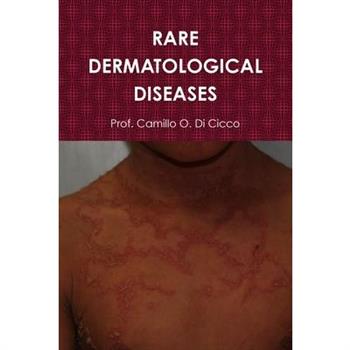 Rare Dermatological Diseases